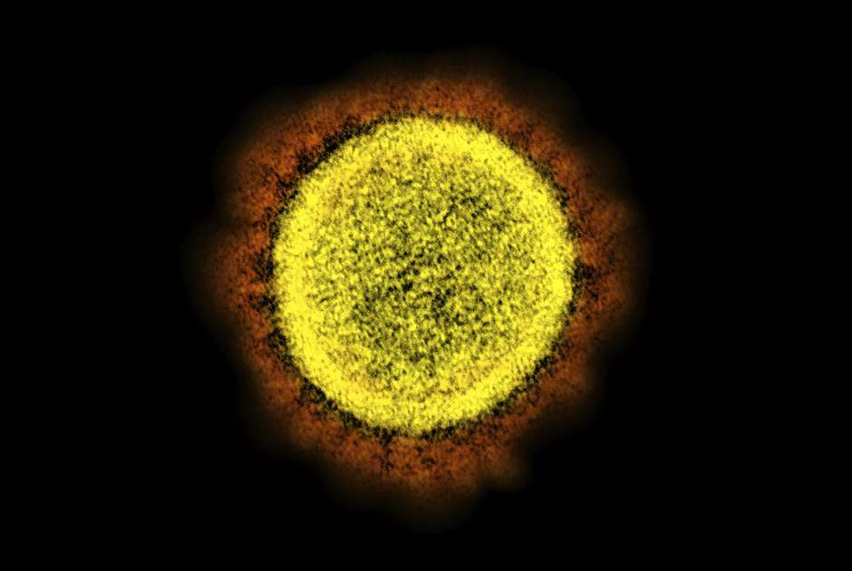 Genetic material from older COVID-19 viruses found in dust could help in outbreak tracking. (NIAID/NIH via AP, File)
