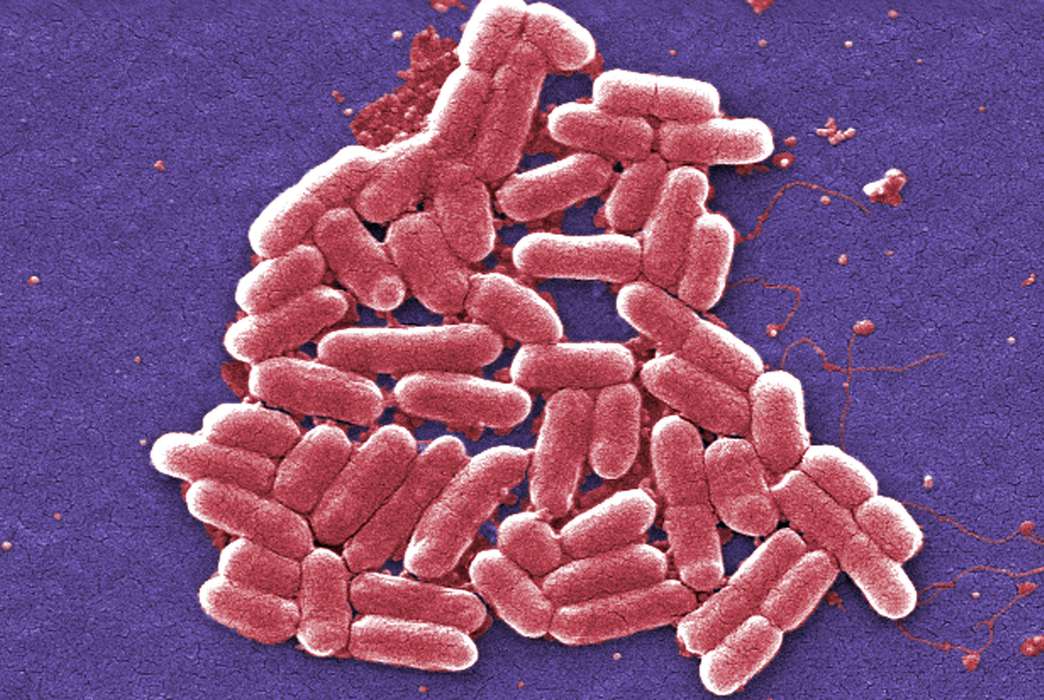 Nanosensor incorporating gold and sugar could protect against E. coli infections. (CDC/Janice Carr)