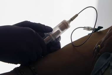 For the first time, a blood test may allow for early detection of ovarian cancer. (AP Photo/Jacqueline Larma)