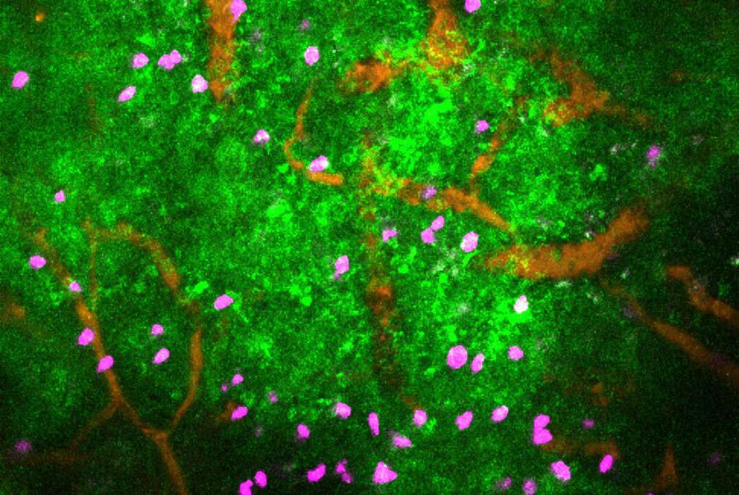 This image shows lymphocytes (purple) among blood vessels (orange), and the calcium signalling (green) that results from noradrenaline neurotransmitter release and causes immune cells to stop moving. (Scott Mueller)